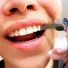 Calibrador de Espaco Interproximal - em uso